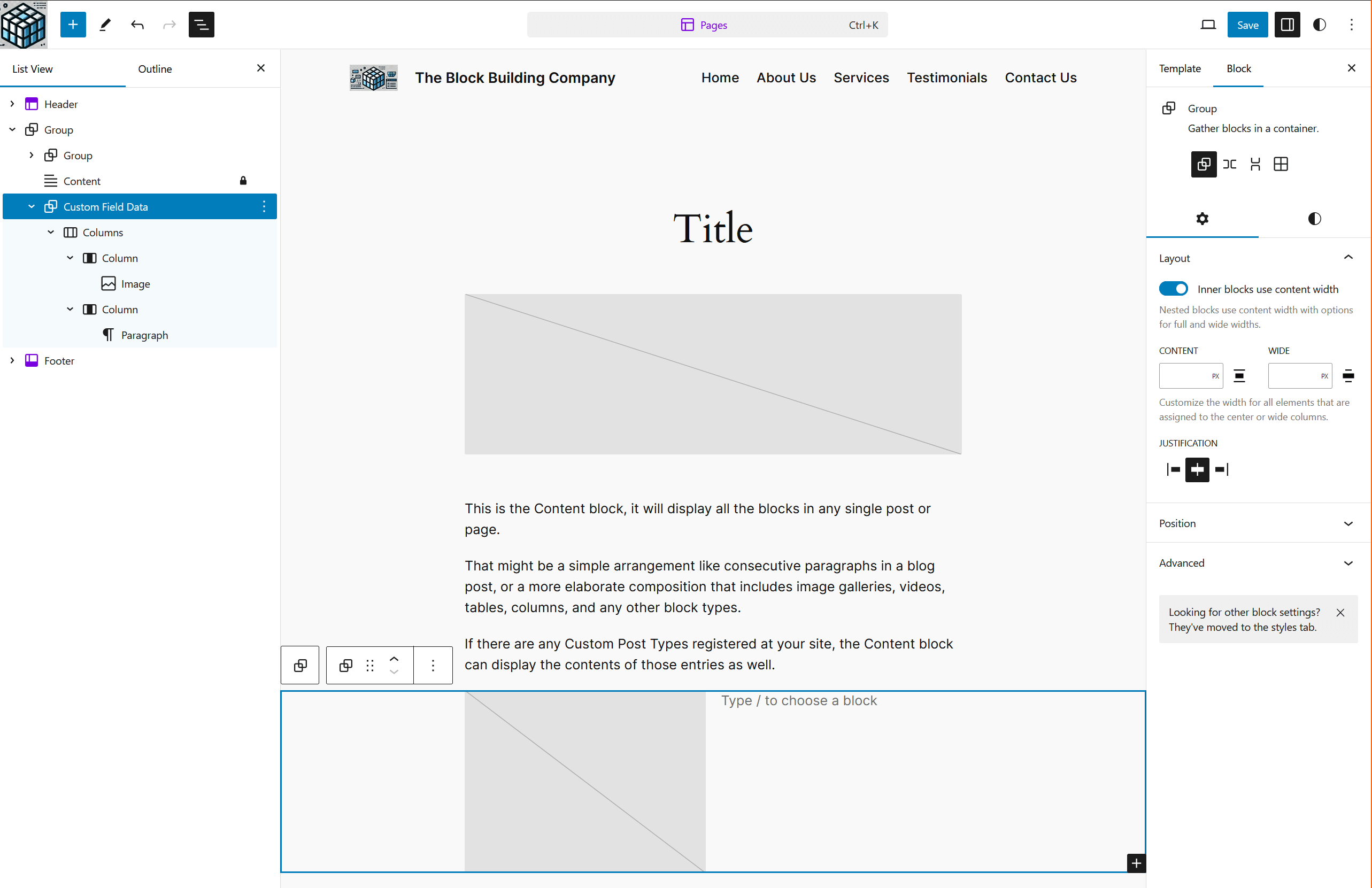 Ajout des blocs qui afficheront les données de notre champ personnalisé